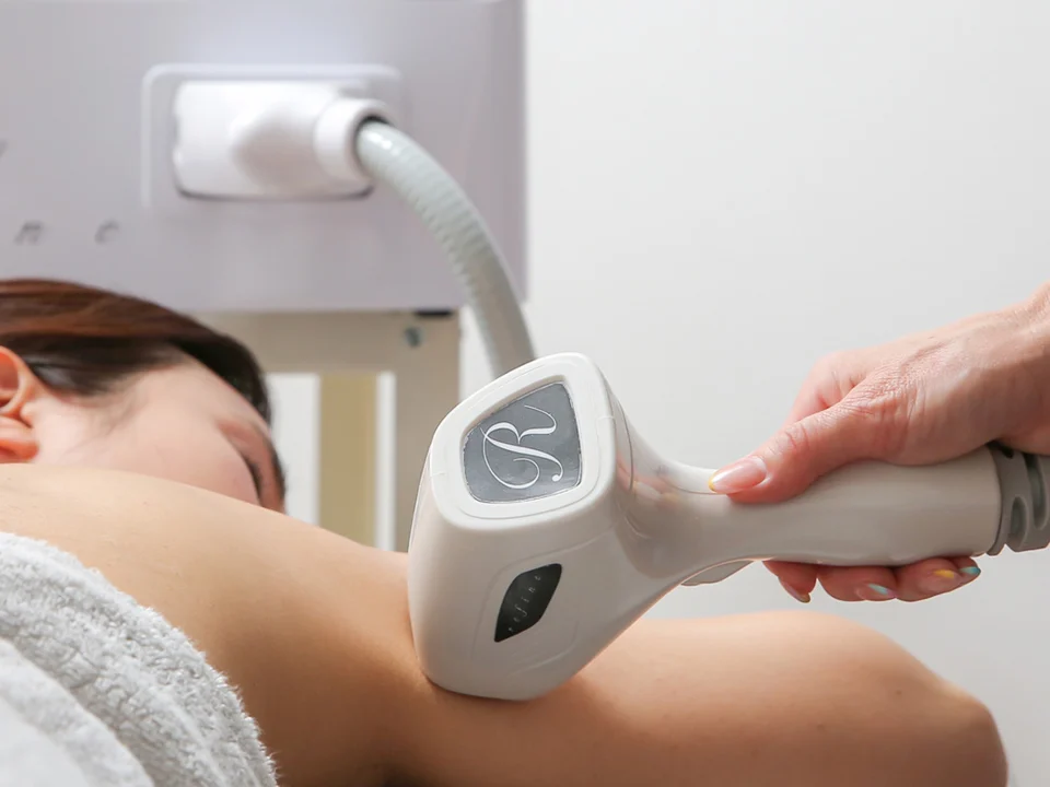 LED脱毛に使う美容機器 REFINE（リファイン）と施術の様子